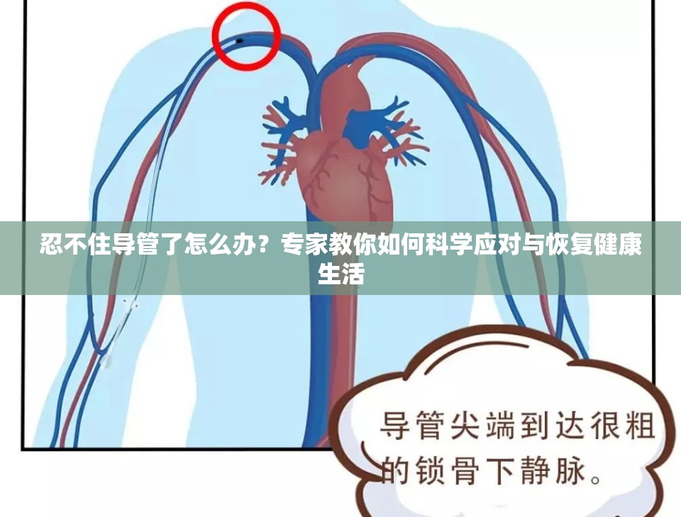 忍不住導管了怎么辦？專家教你如何科學應對與恢復健康生活